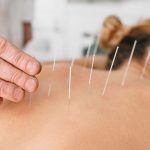 Acupuncture traditionnelle Comprendre ses principes