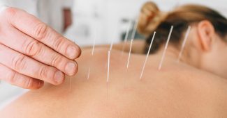 Acupuncture traditionnelle Comprendre ses principes