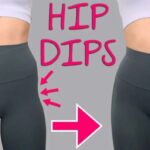 Conseils pré et post-opératoires pour un lipofilling réussi des Hip dips