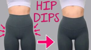 Conseils pré et post-opératoires pour un lipofilling réussi des Hip dips